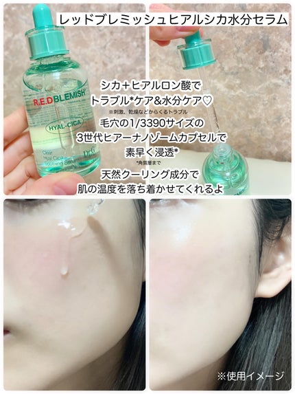 レッドブレミッシュ クリアスージングクリーム/Dr.G/フェイスクリームを使ったクチコミ(2枚目)