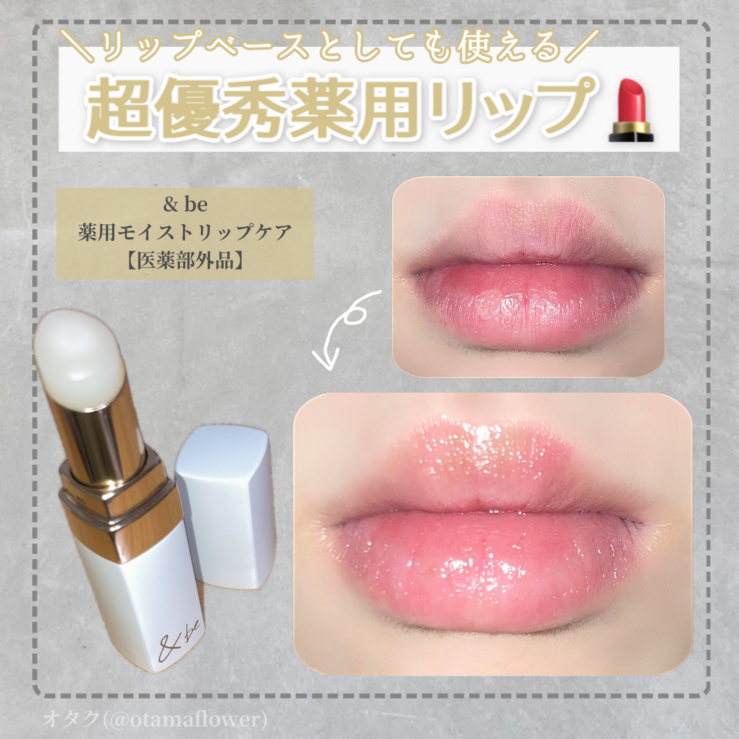 ＆be 薬用モイストリップケア【医薬部外品】/＆be/リップクリームを使ったクチコミ（1枚目）