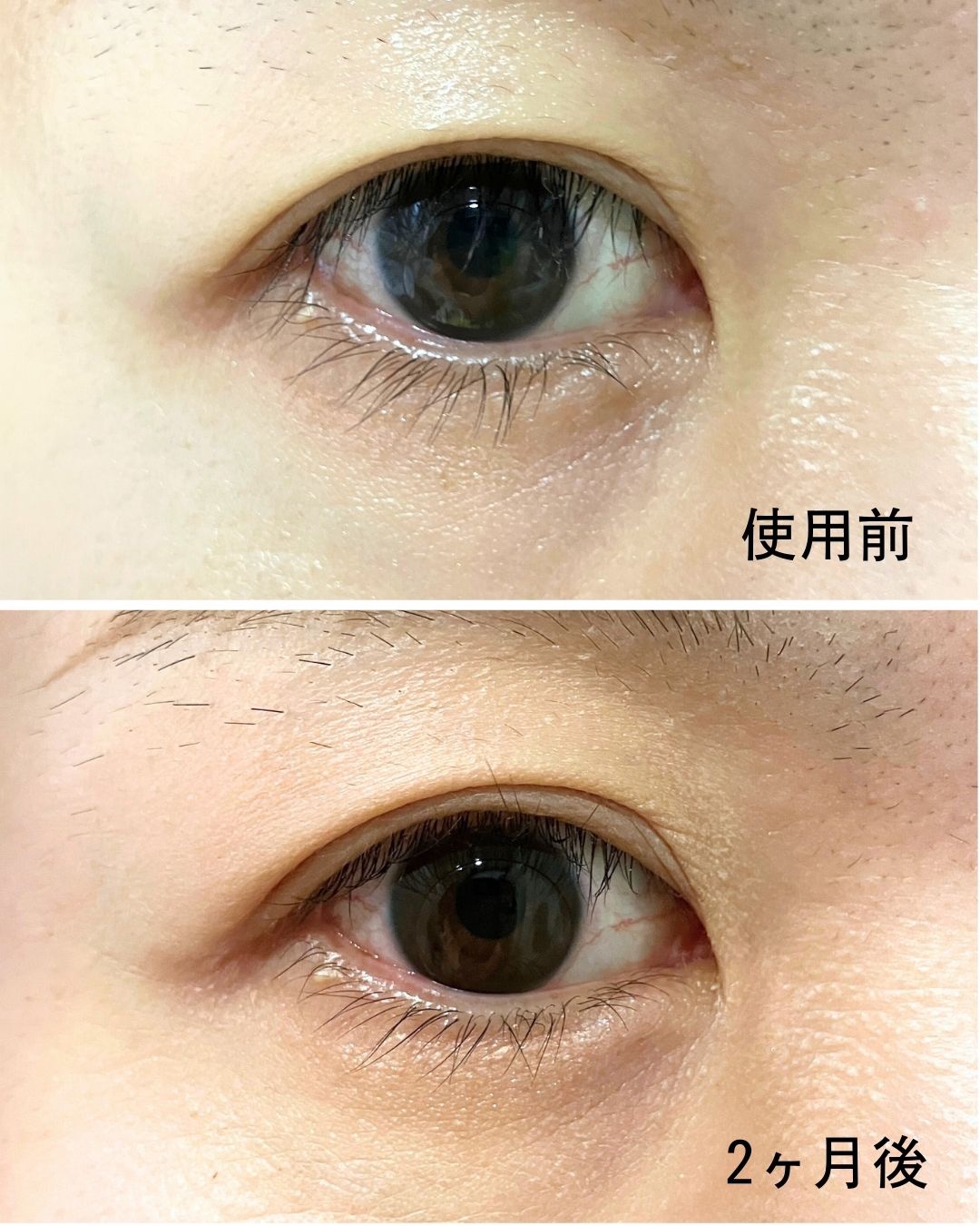 アイラッシュセラム/Bio Lucia(ビオルチア)/まつげ美容液を使ったクチコミ（3枚目）