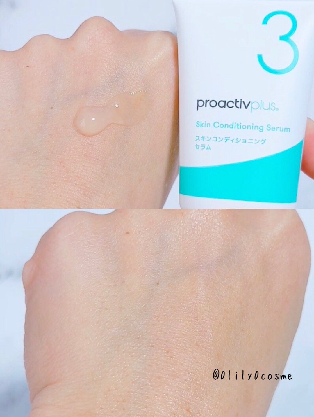 プロアクティブ プラス 薬用スマートセット/プロアクティブ/スキンケアキットを使ったクチコミ(6枚目)