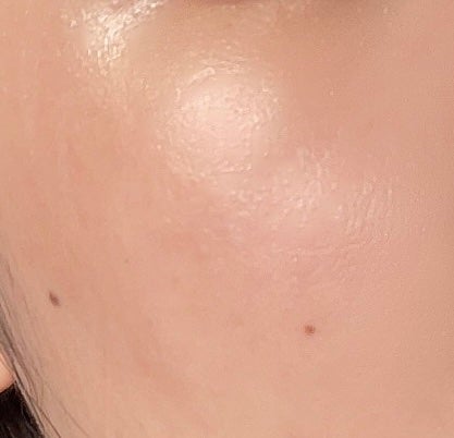 ビタミンC アスタキサンチンセラム/VT/美容液を使ったクチコミ(5枚目)