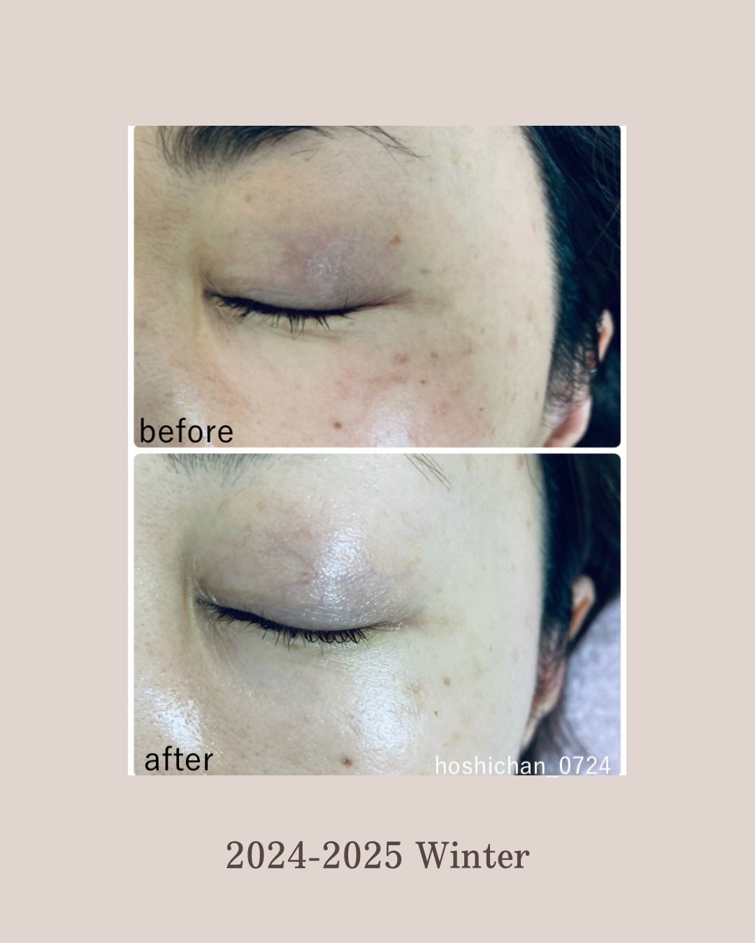 ほし⭐︎フォロバします♪(元美容部員) on LIPS 「・2024–2025Winterskinrecord📓※個人的..」(3枚目)