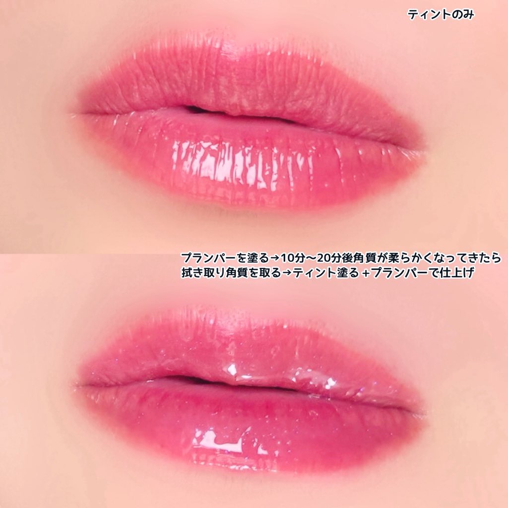 フレイムライトリッププランパー/LoNLy /リッププランパーを使ったクチコミ（3枚目）