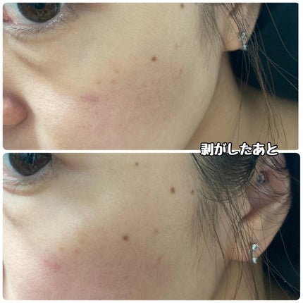 PDRNリジュべネティングフルインハイドロゲルマスク/SAM'U/シートマスク・パックを使ったクチコミ(4枚目)