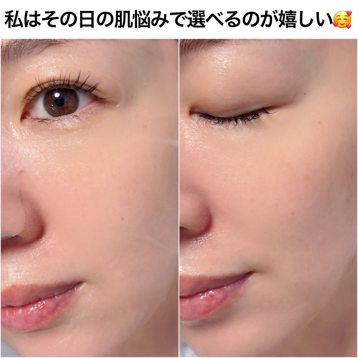 ピュレア リジュオンハイドレイトリペアエッセンスマスク/ピュレア/シートマスク・パックを使ったクチコミ(6枚目)