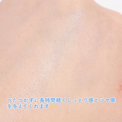 アロエバリアサポートクリーム/glow/フェイスクリームを使ったクチコミ(4枚目)