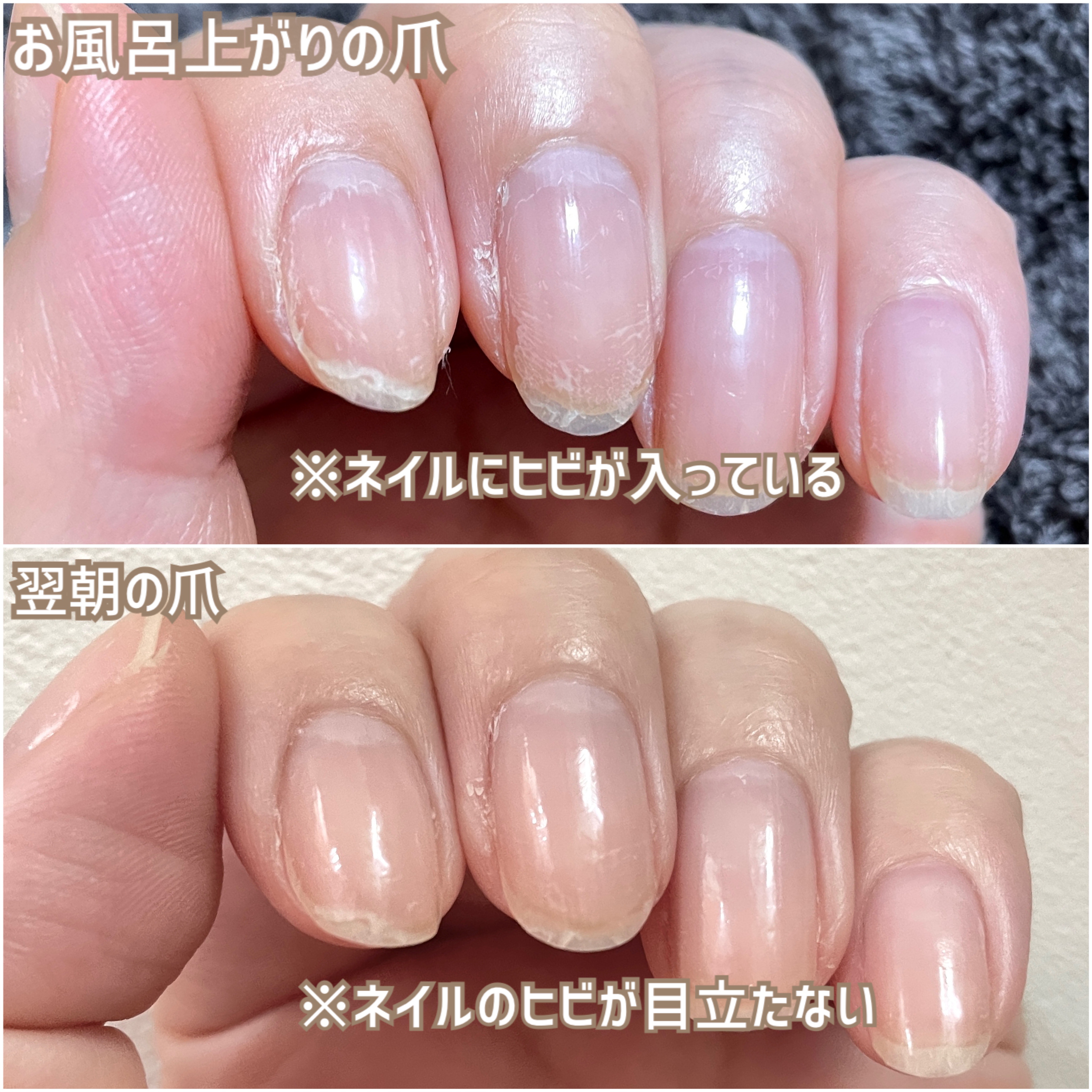 ディーアップファンデーション/D-UP/ネイルベースコートを使ったクチコミ（2枚目）