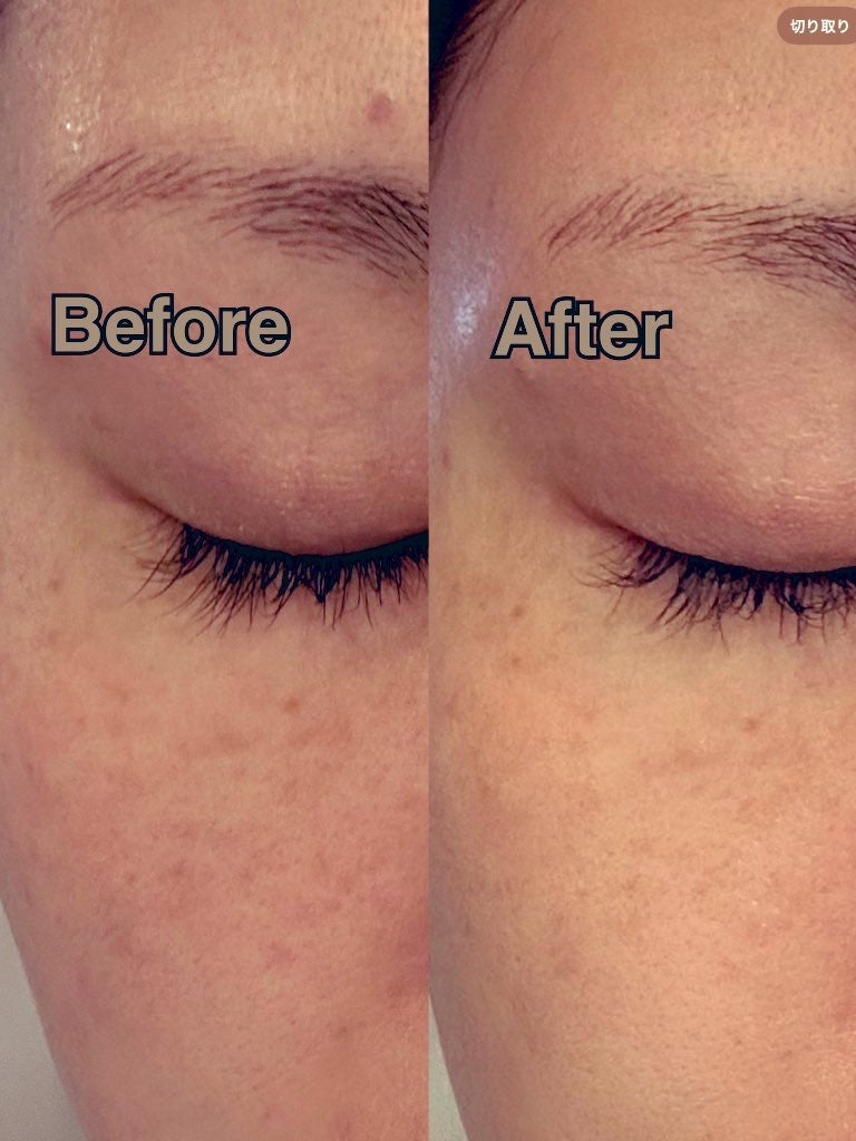 優美 on LIPS 「#PR紫外線が強く日焼けも気になる時にぴったりなスキンケアに出..」(2枚目)