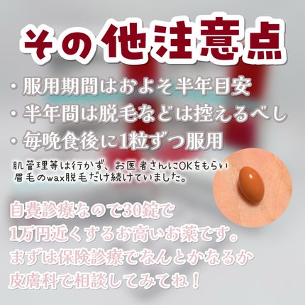 ããŒã¡ðž on LIPS ãä»å¹Žã®ãã¹ãã³ã¹ã¡(ïŒ)ã¯ã€ãœãã¬ããã€ã³ã§ããèªç¶è±ããªå
«ç..ãïŒ3æç®ïŒ