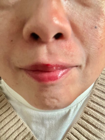 hirokoðžã¹ãã³ã±ã¢&ã³ã¹ã¡å€§å¥œã on LIPS ãINGAæ°äœãªãããã£ã³ããã詊ãâšâšINGAãŠã©ãŒã¿ãŒããã«..ãïŒ4æç®ïŒ