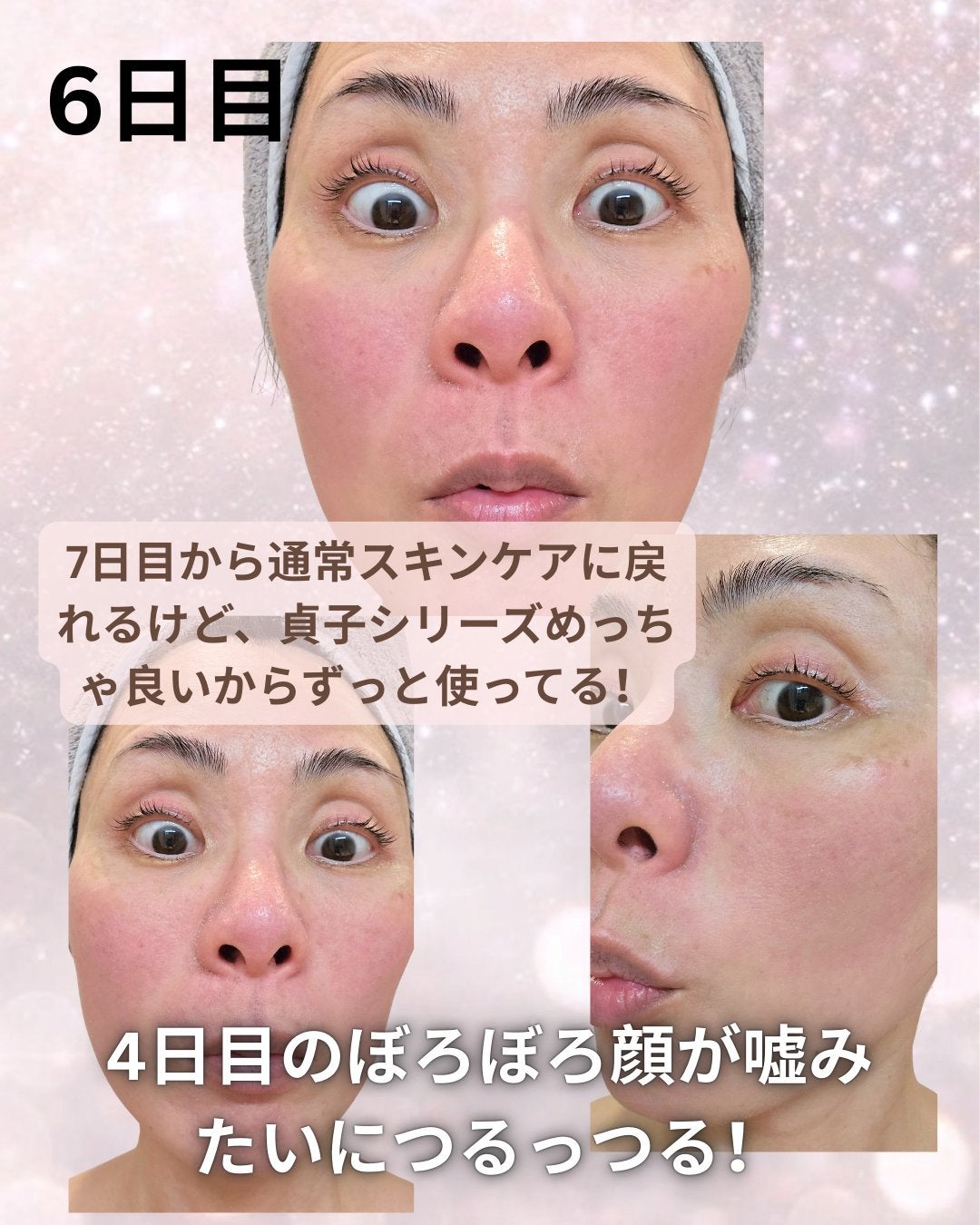 菅貞子ハーブピーリングシリーズ化粧ジェル/KANSADAKO/化粧水を使ったクチコミ(7枚目)