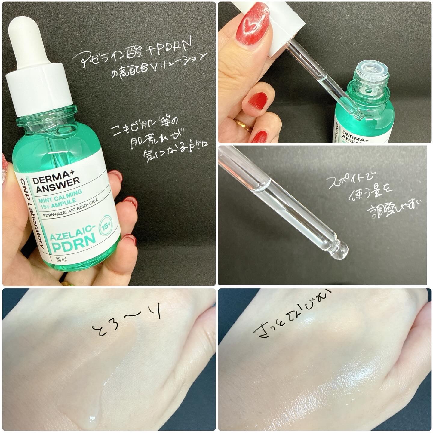 ダーマアンサーアゼライン酸ミントアンプル/CNP Laboratory/美容液を使ったクチコミ（2枚目）