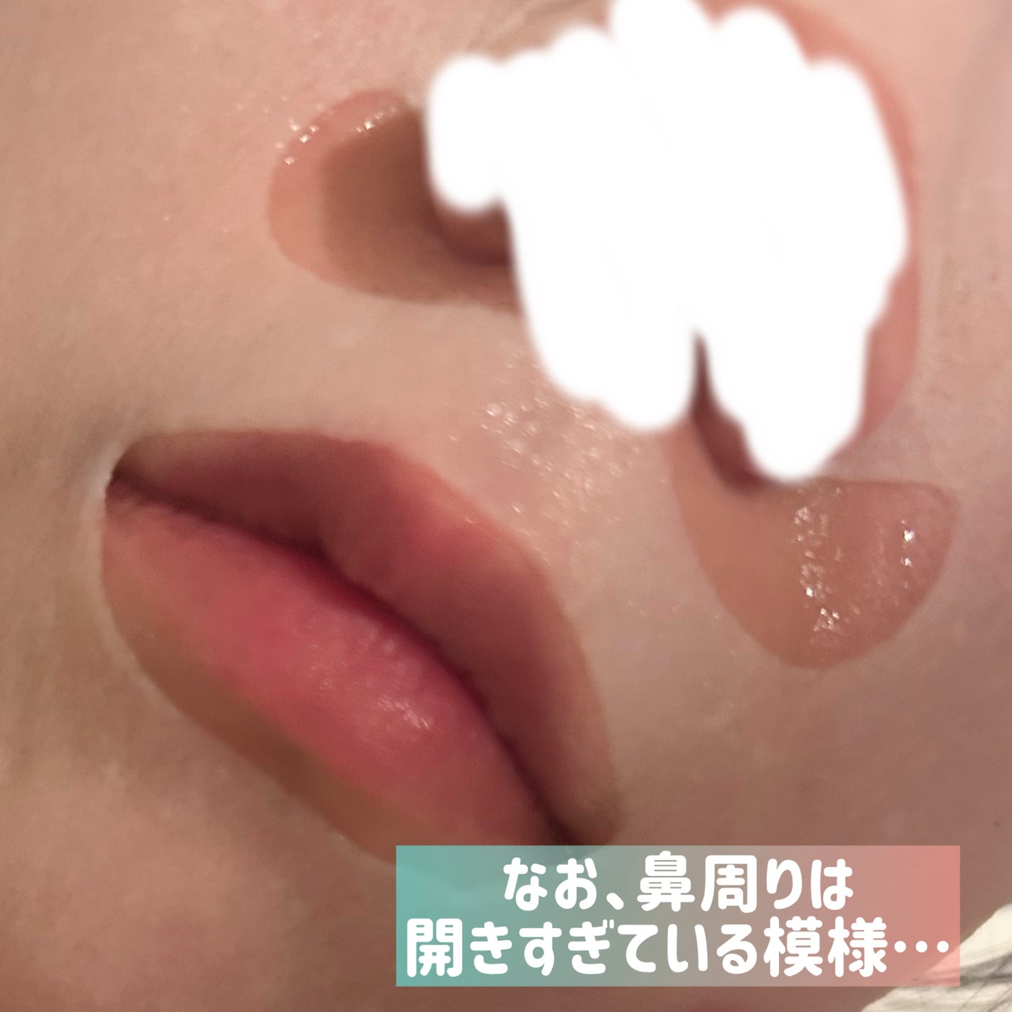 ã«ã«ã«ã³ãã¬ã·ã£ã¹ GREENïŒGlow UpïŒ/ã«ã«ã«ã³/ã·ãŒããã¹ã¯ã»ããã¯ã䜿ã£ãã¯ãã³ãïŒ6æç®ïŒ