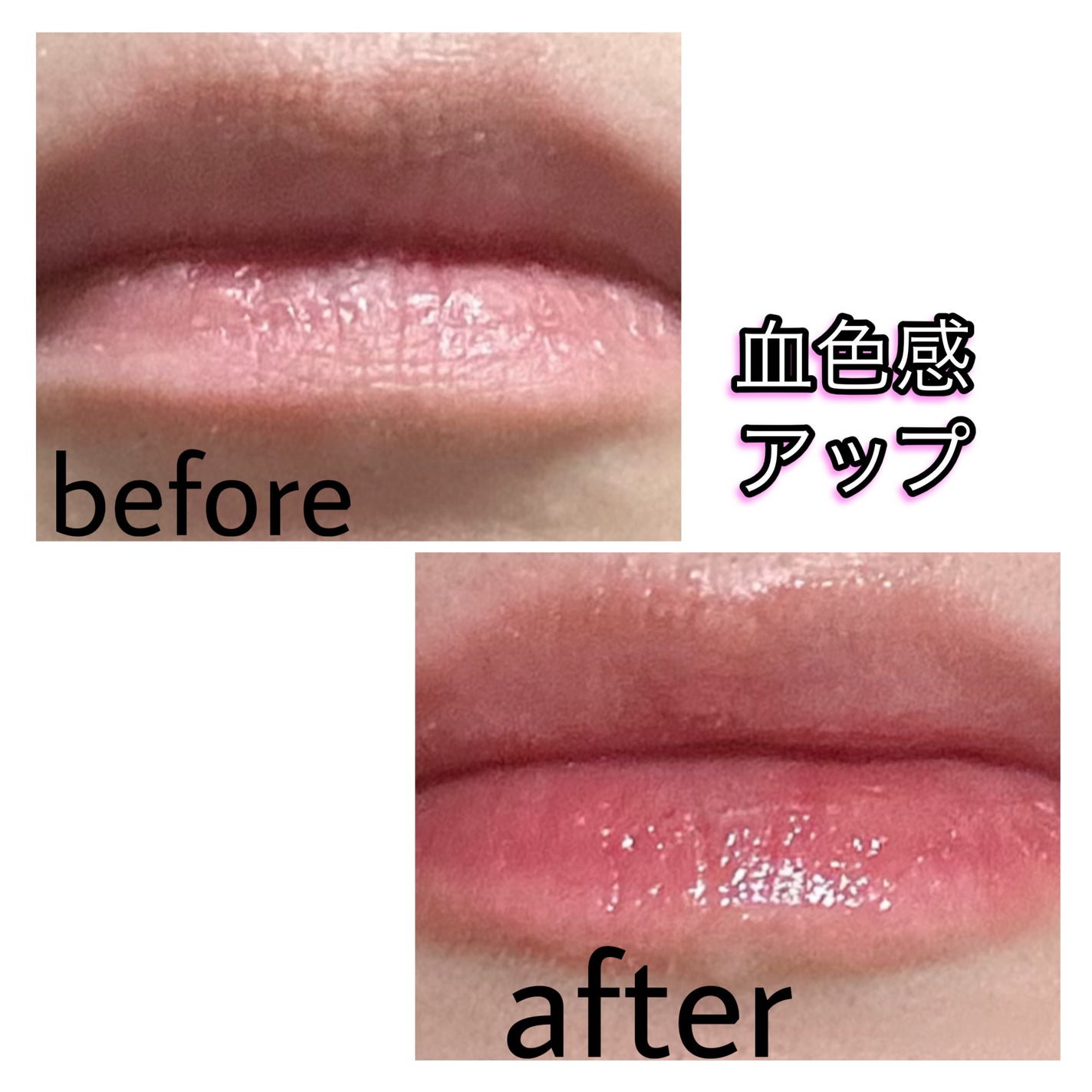 キューミ―ボムショットリッププランパー/AGARISM/リッププランパーを使ったクチコミ(5枚目)