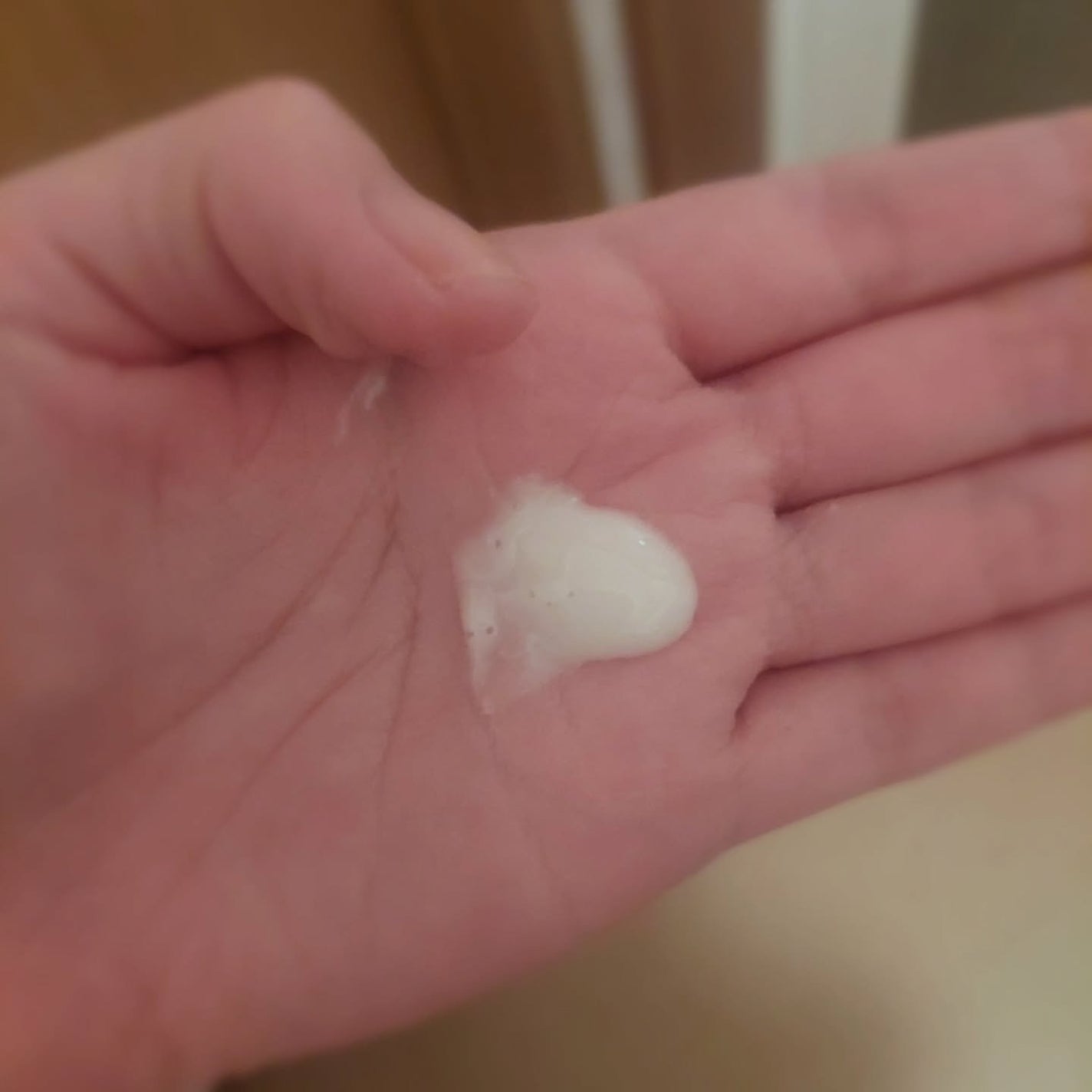 薬用u ローション/AK usual/化粧水を使ったクチコミ(5枚目)