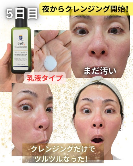 菅貞子ハーブピーリングシリーズ化粧ジェル/KANSADAKO/化粧水を使ったクチコミ(6枚目)