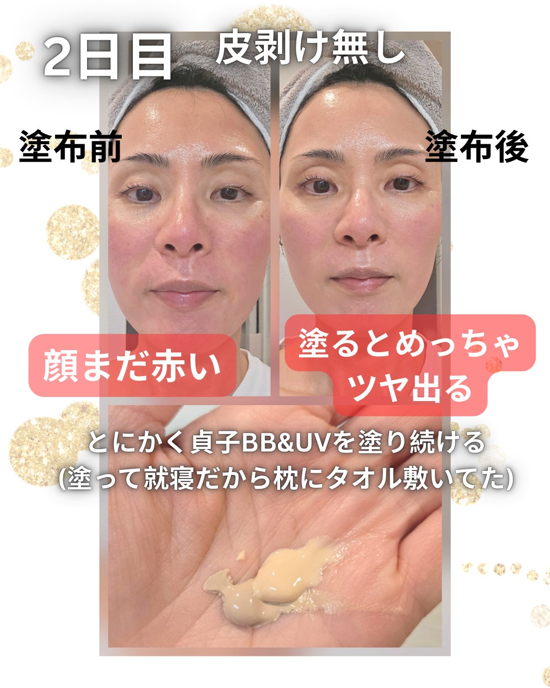 菅貞子ハーブピーリングシリーズ化粧ジェル/KANSADAKO/化粧水を使ったクチコミ（3枚目）