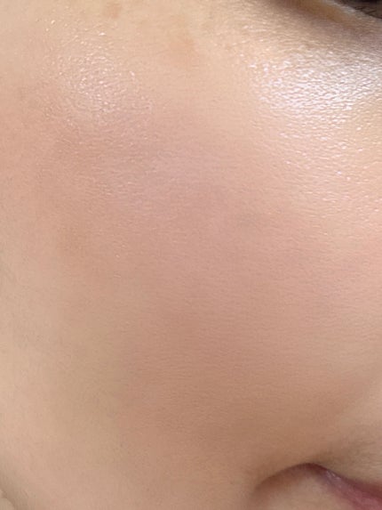 リードルショット100/VT/美容液を使ったクチコミ(3枚目)