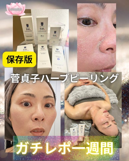 菅貞子ハーブピーリングシリーズ化粧ジェル/KANSADAKO/化粧水を使ったクチコミ(1枚目)