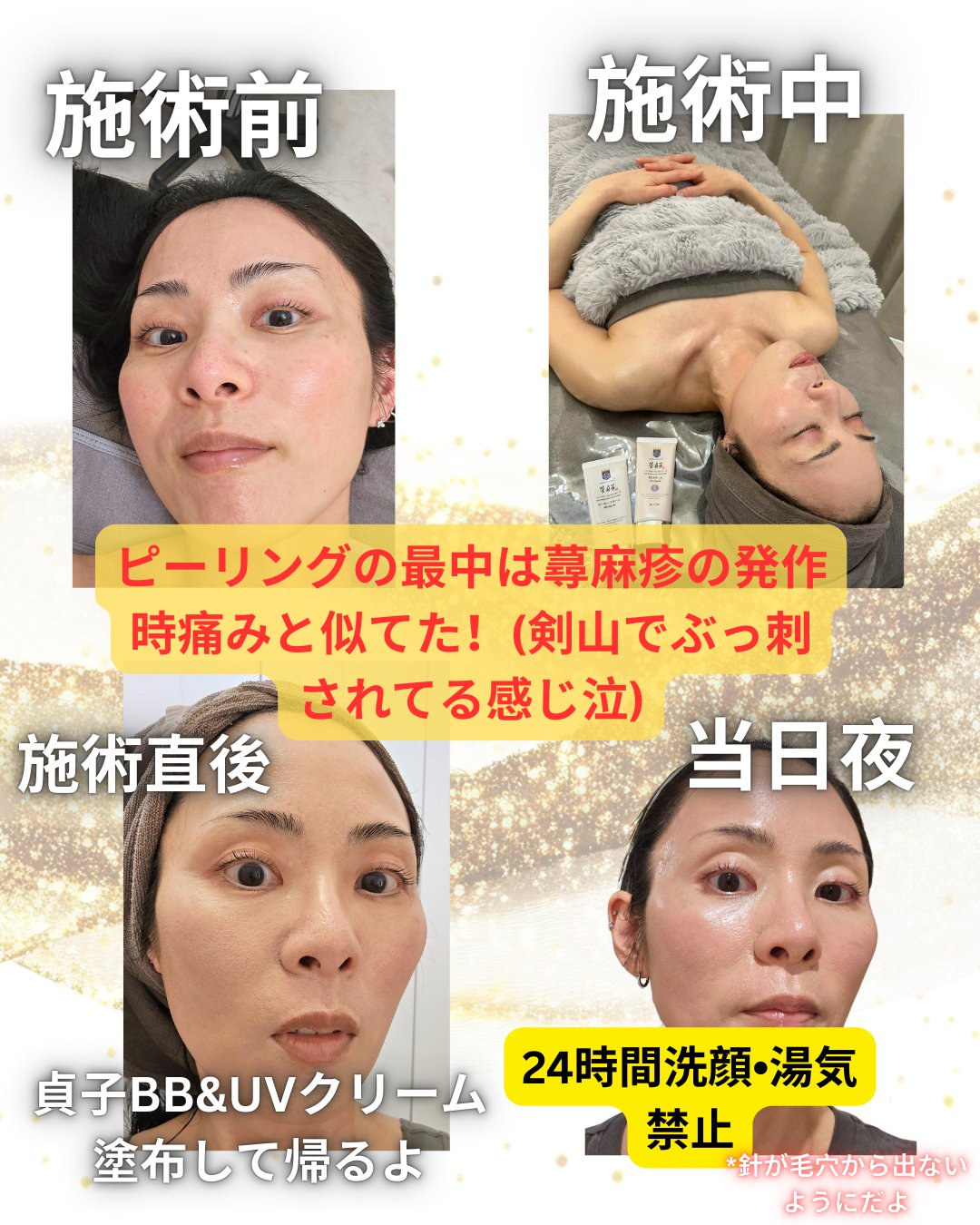 菅貞子ハーブピーリングシリーズ化粧ジェル/KANSADAKO/化粧水を使ったクチコミ（2枚目）