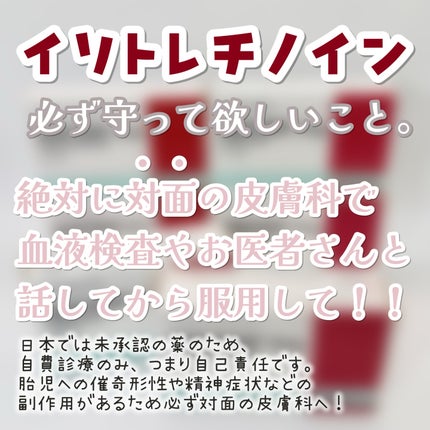 ããŒã¡ðž on LIPS ãä»å¹Žã®ãã¹ãã³ã¹ã¡(ïŒ)ã¯ã€ãœãã¬ããã€ã³ã§ããèªç¶è±ããªå
«ç..ãïŒ2æç®ïŒ