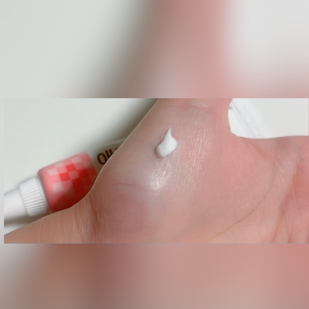 アクノンクリーム/東亜製薬/その他スキンケアを使ったクチコミ（3枚目）