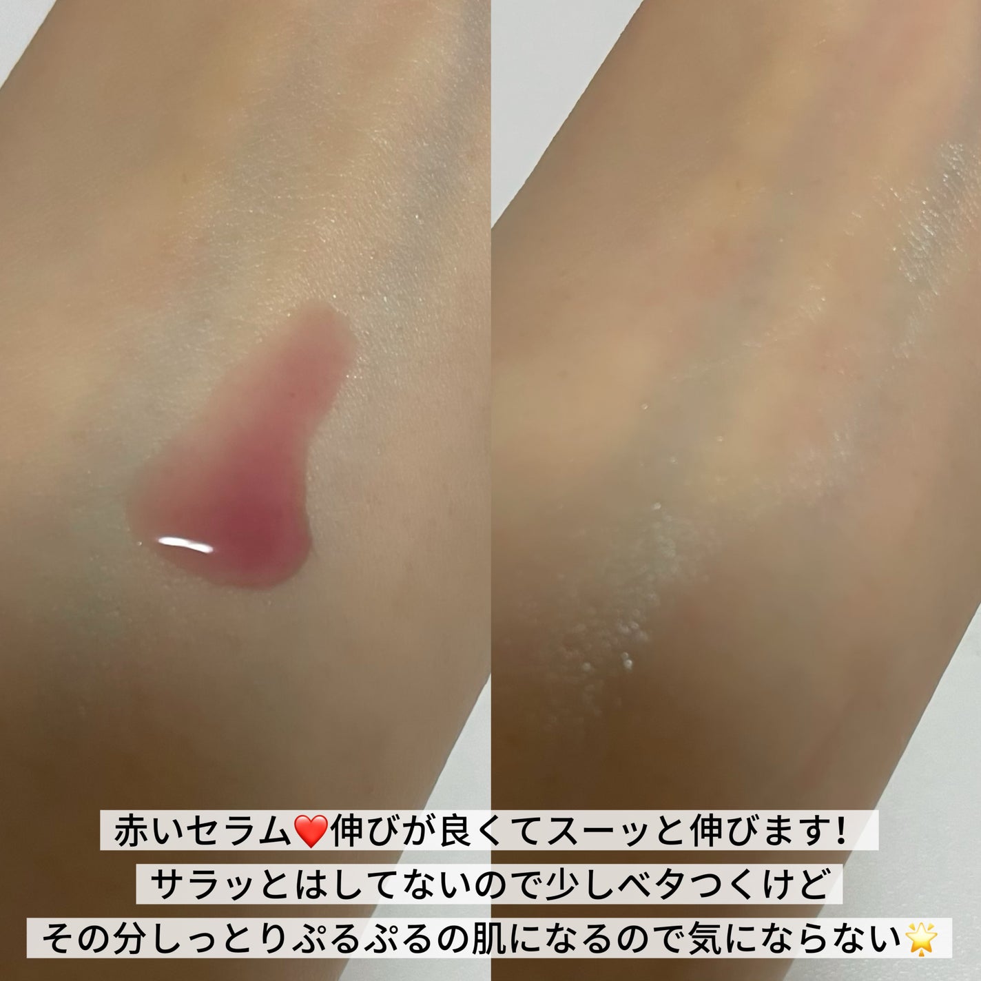 PDRNアルティメットオーラターゲットセラム/SAM'U/美容液を使ったクチコミ(3枚目)