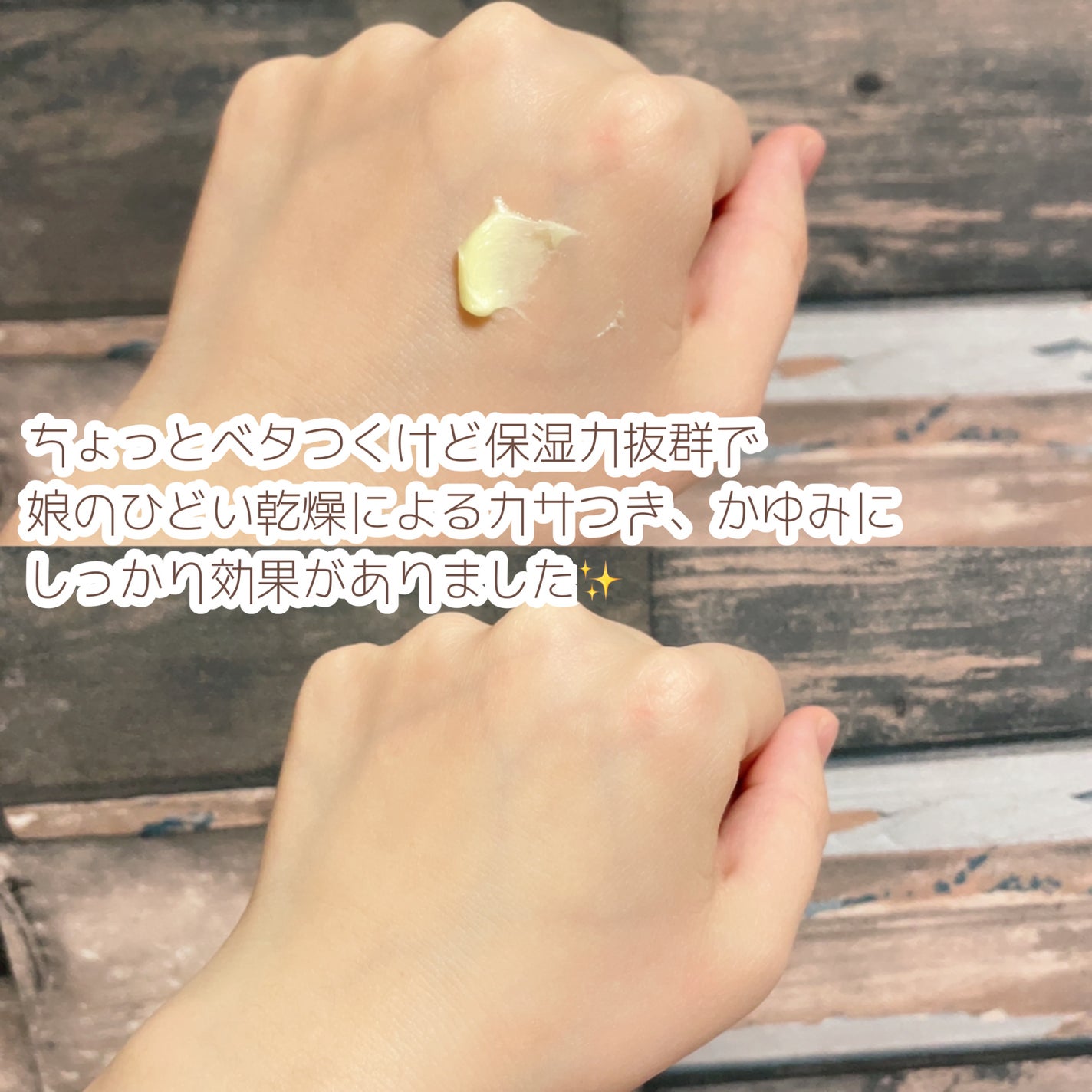 ユースキン/ユースキン/ボディクリームを使ったクチコミ(4枚目)