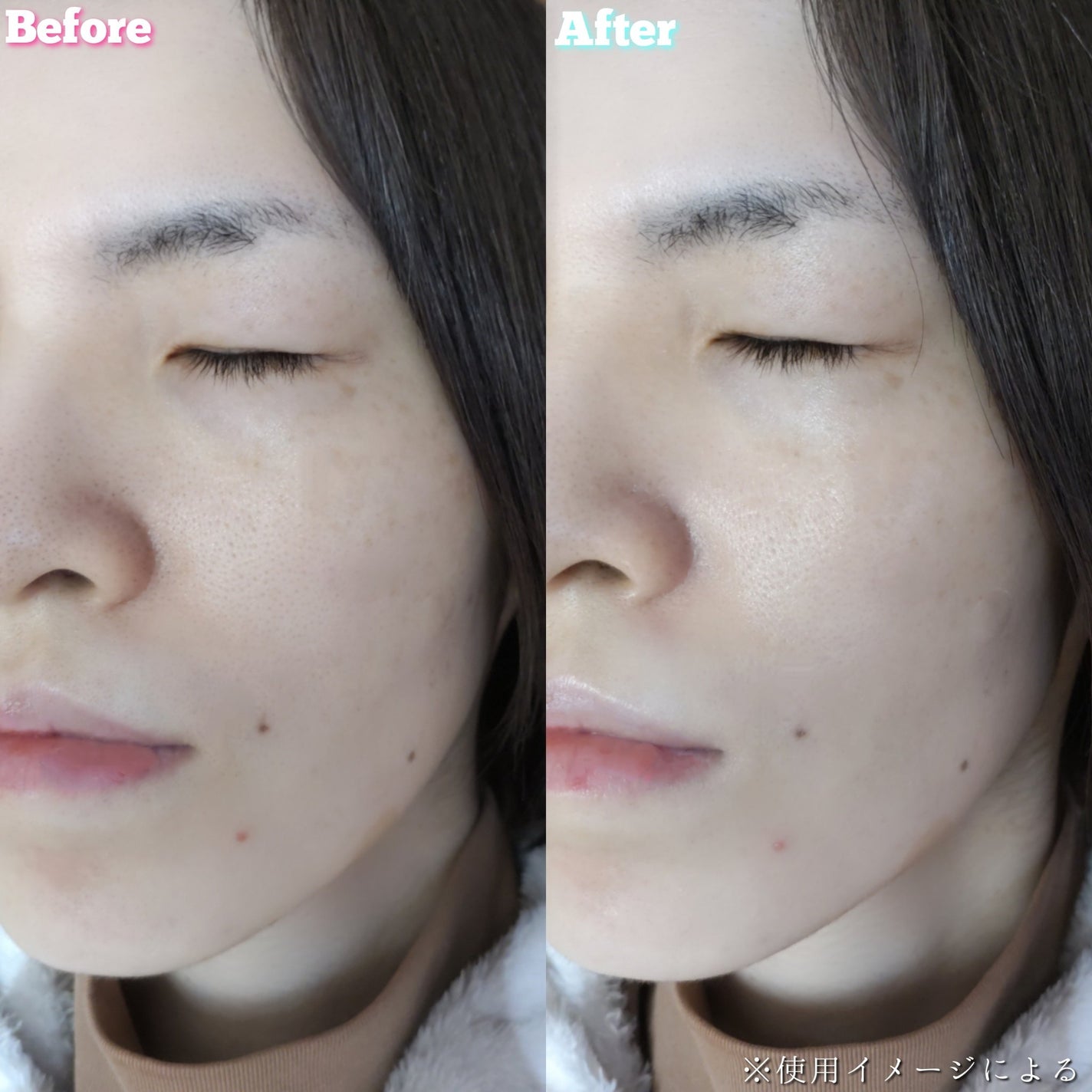 グルタチオン トーンオンセラム/VT/美容液を使ったクチコミ(5枚目)