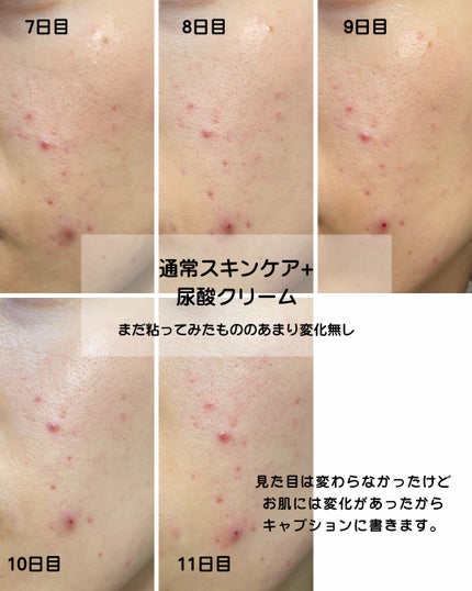 nano |アラサー目線レビュー on LIPS 「◀︎◀︎コスメやスキンケアの情報はこちらから—————————..」(5枚目)