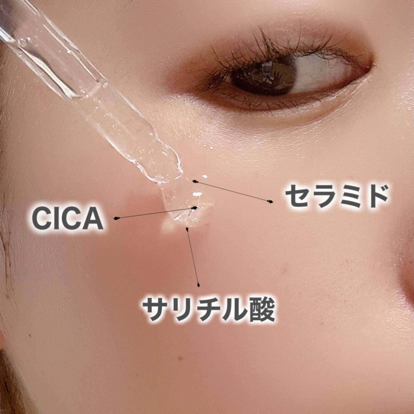 アネトス アクネケア トリートメント セラム/Anetos/美容液を使ったクチコミ(4枚目)