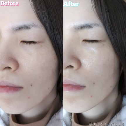 グルタチオン トーンオンセラム/VT/美容液を使ったクチコミ(8枚目)