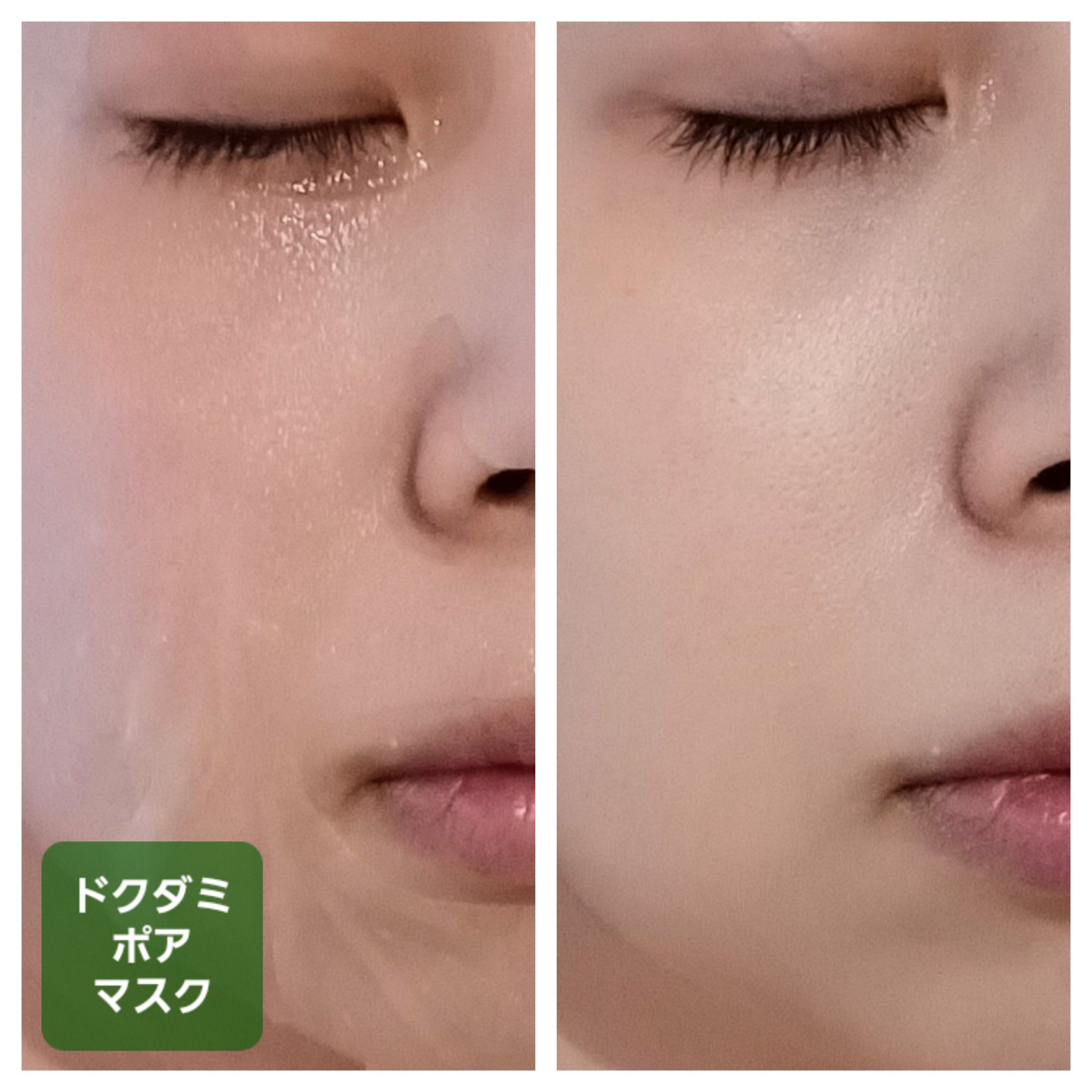 プラムグローマスク/ISOI/シートマスク・パックを使ったクチコミ（3枚目）