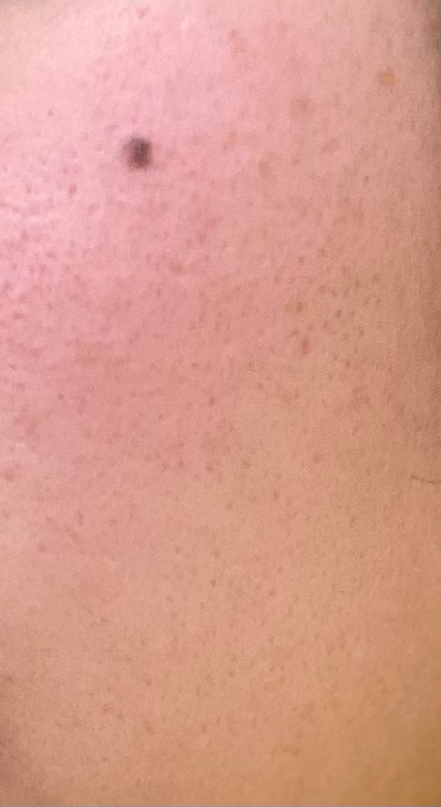 もえか on LIPS 「提供いただきました✨1週間使ってみました。劇的な変化はまだない..」(2枚目)