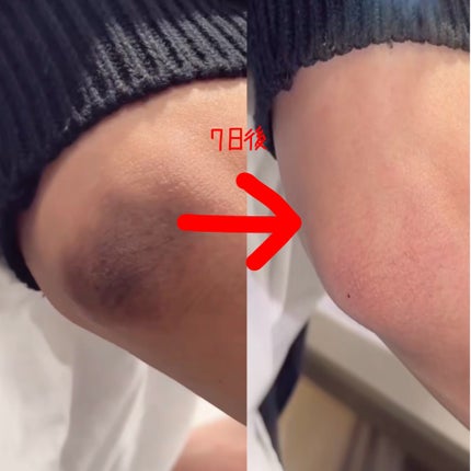 ビタC グリーンティーエンザイム ブライト セラム/innisfree/美容液を使ったクチコミ(2枚目)