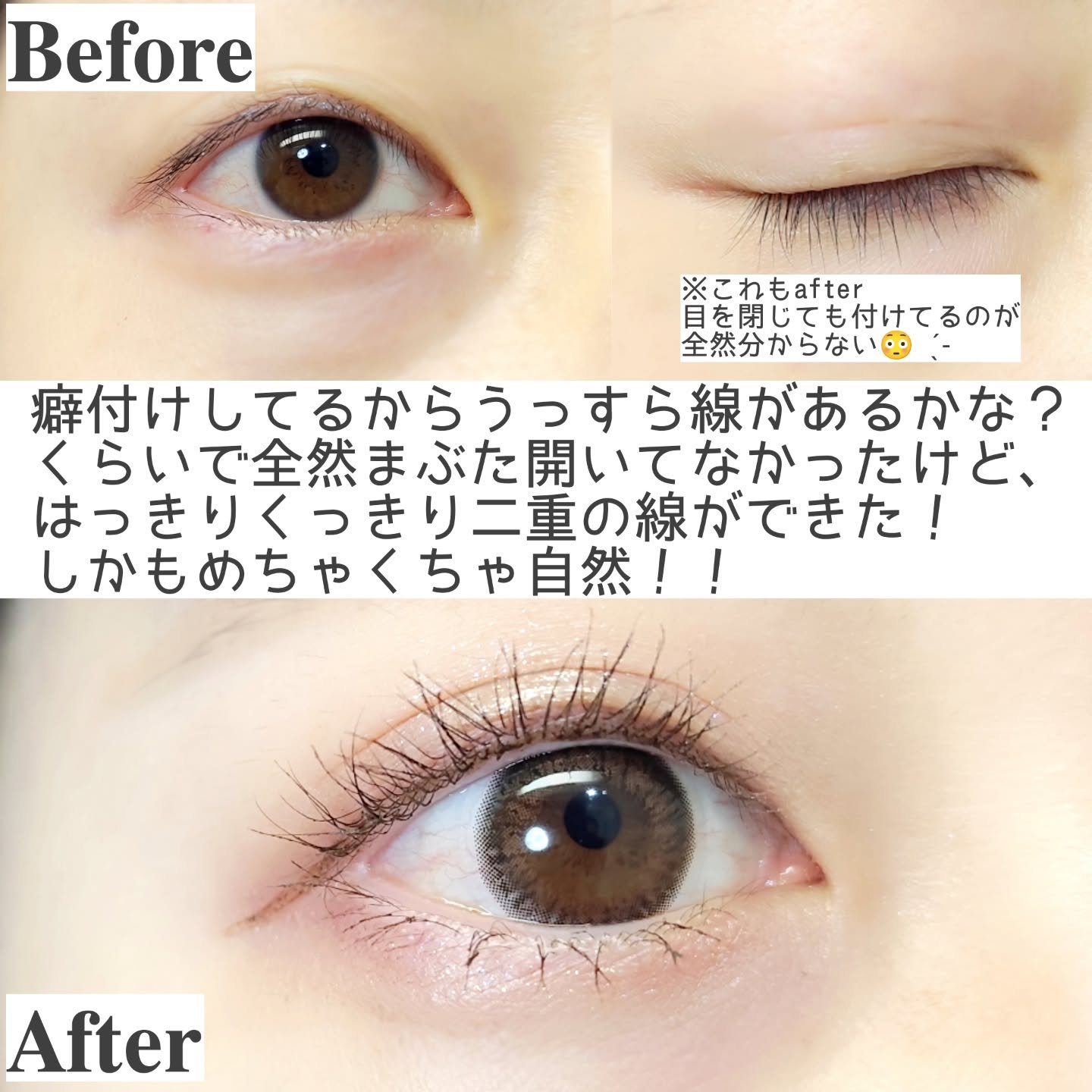 メザイク フリーファイバー120 スタンダードタイプ /メザイク/二重まぶた用アイテムを使ったクチコミ（2枚目）