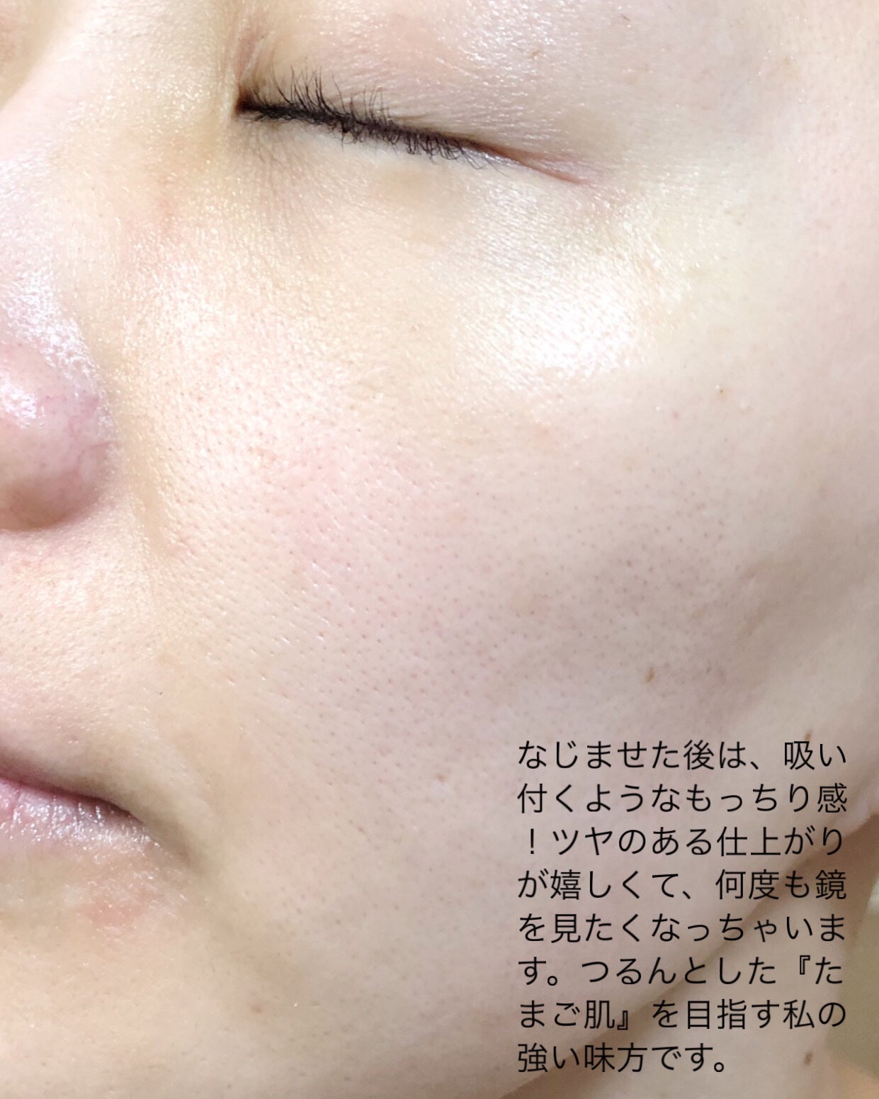 ダーメラ PDRNショット・毛穴アンプル/Dermela/美容液を使ったクチコミ(4枚目)