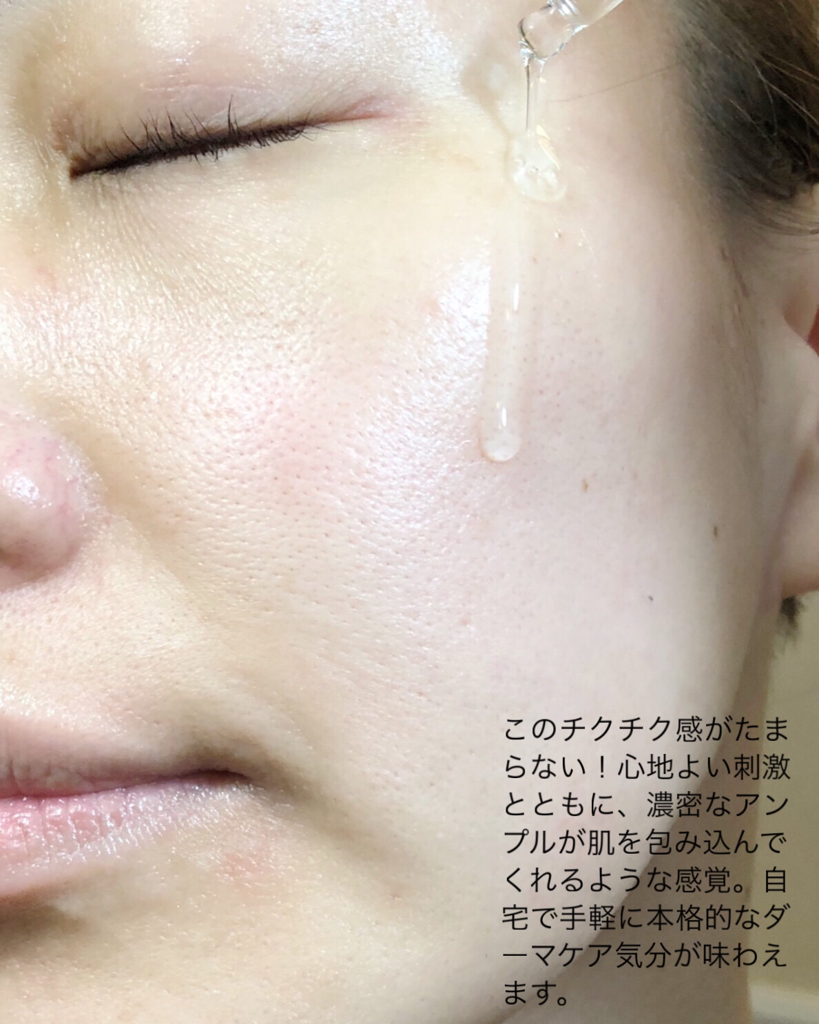 ダーメラ PDRNショット・毛穴アンプル/Dermela/美容液を使ったクチコミ（3枚目）