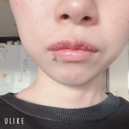 ハム太郎 on LIPS 「#Mリップ#ダウンタイム..」(5枚目)