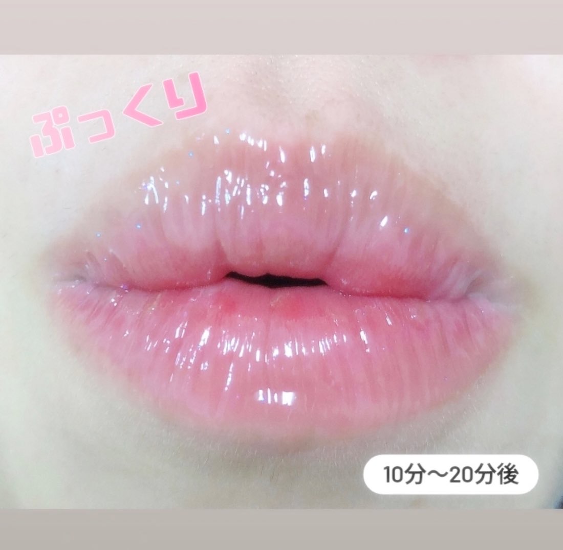 フレイムライトリッププランパー/LoNLy /リッププランパーを使ったクチコミ（2枚目）