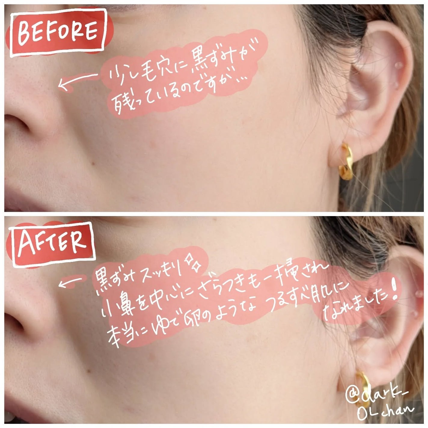 AHA 9.12 オミジャ 陶器肌 ウォッシュオフ セラム/parnell/美容液を使ったクチコミ(4枚目)