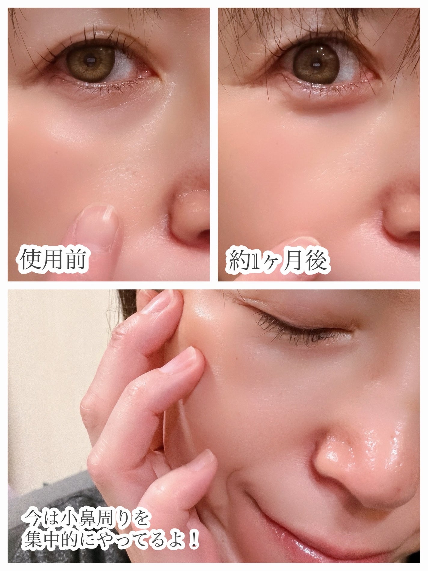 ペンタショット/CELORABY/美顔器・マッサージを使ったクチコミ(3枚目)