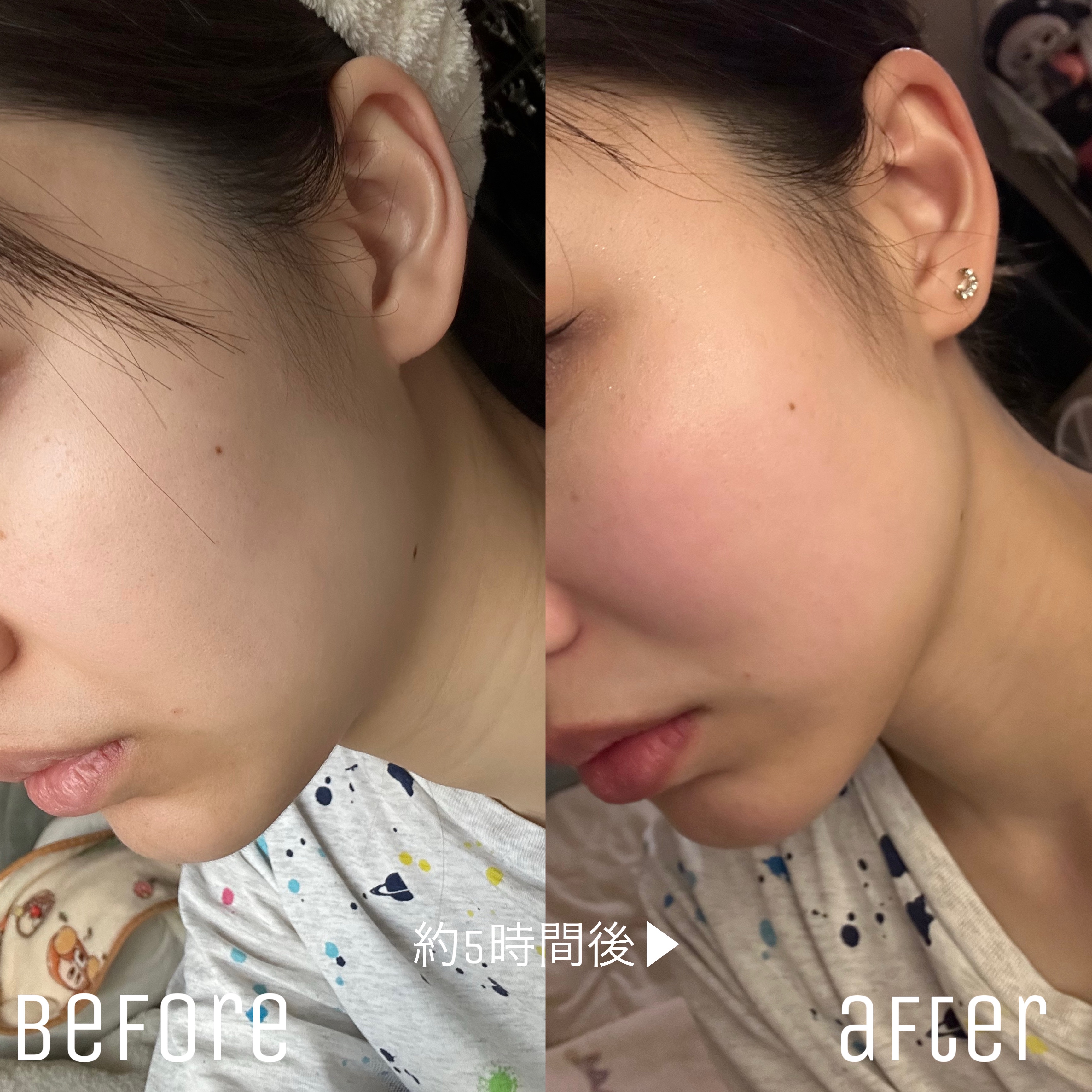 Earbomb/keybo/その他を使ったクチコミ（2枚目）