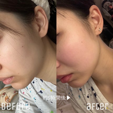 Earbomb/keybo/その他を使ったクチコミ(2枚目)