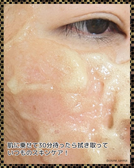 メディプローラー CO2ジェルマスク/ドクターメディオン/洗い流すパック・マスクを使ったクチコミ(4枚目)