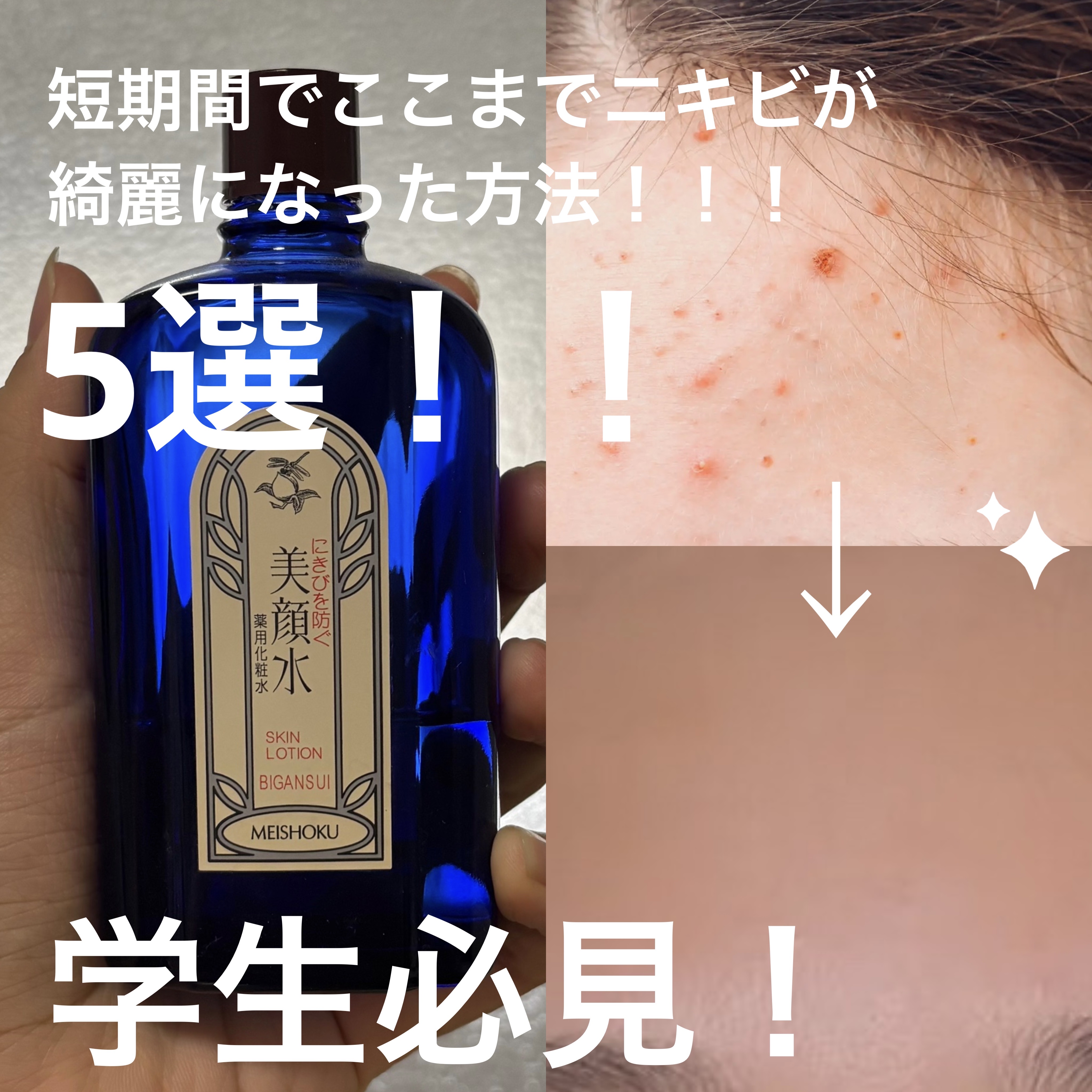 明色美顔水 薬用化粧水/美顔/化粧水を使ったクチコミ（1枚目）