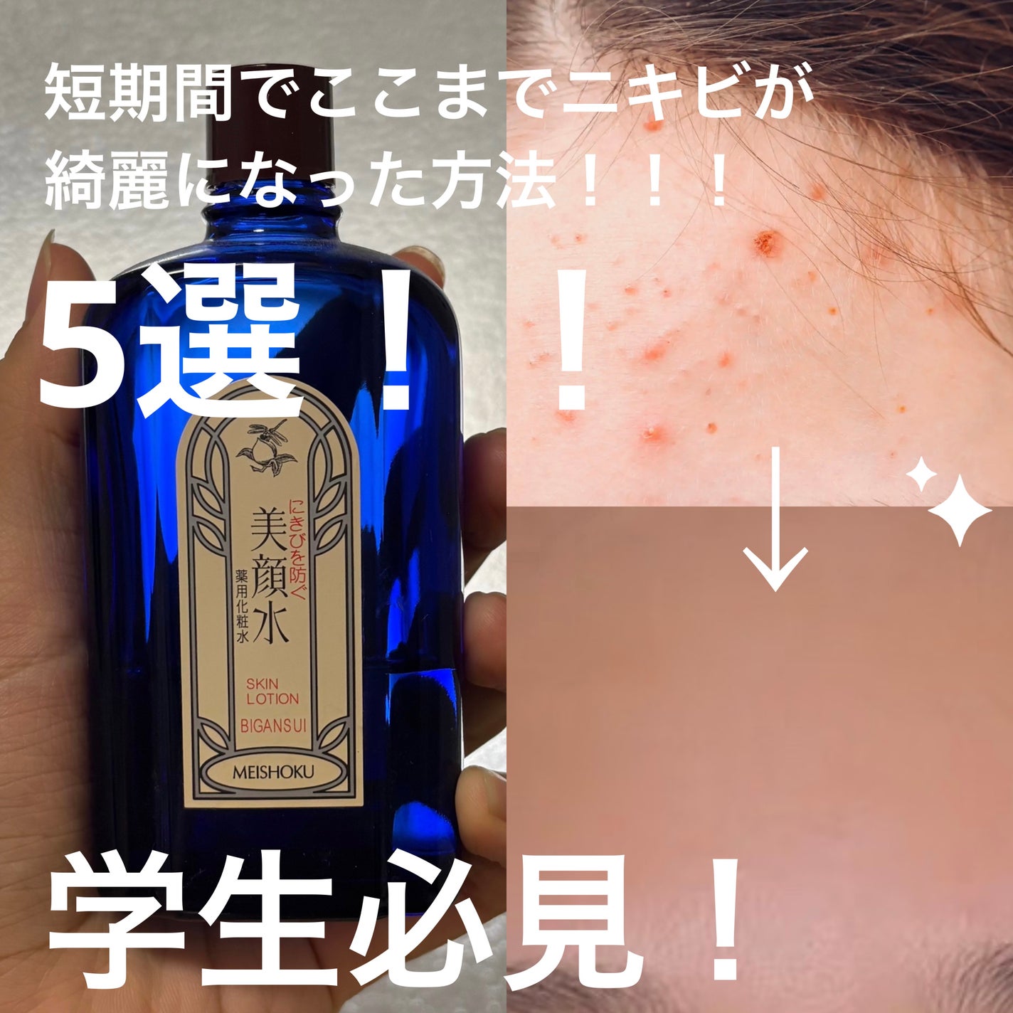 明色美顔水 薬用化粧水/美顔/化粧水を使ったクチコミ(1枚目)