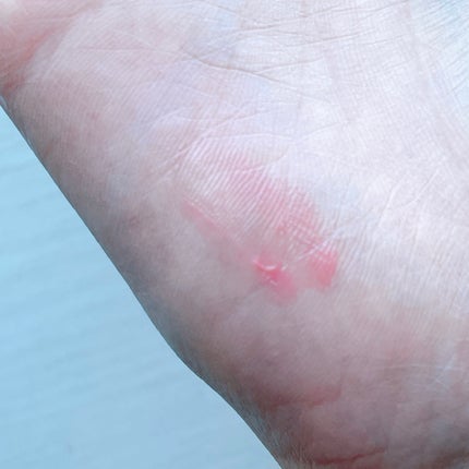 ペトロリューム ジェリー リップ レギュラー/ヴァセリン/リップクリームを使ったクチコミ(5枚目)