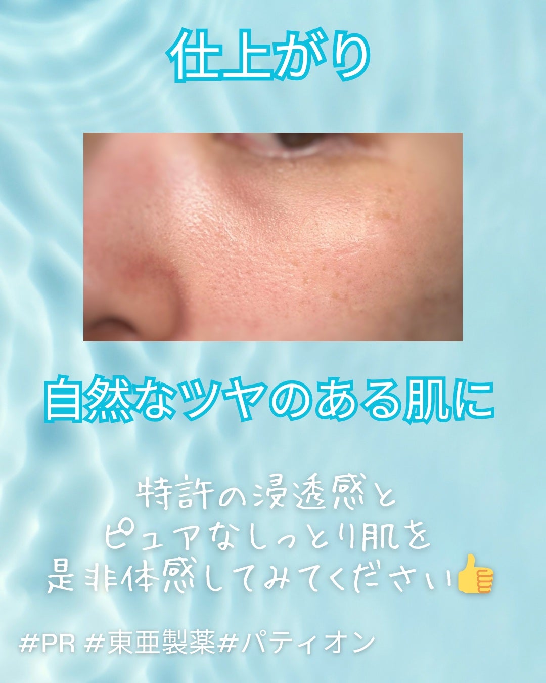 ノスカナイン T セラムマスク S/FATION/シートマスク・パックを使ったクチコミ(4枚目)