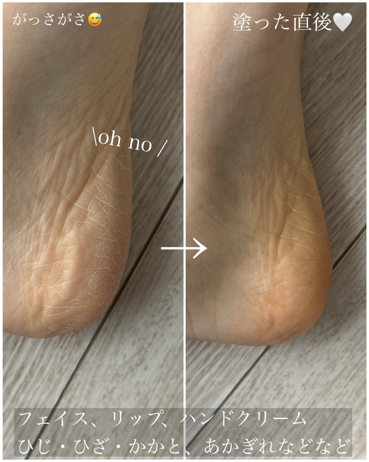 HiTOKi(ハイトキ)　保湿バーム 飛騨山 熊の油/HiTOKi/ボディローションを使ったクチコミ（3枚目）